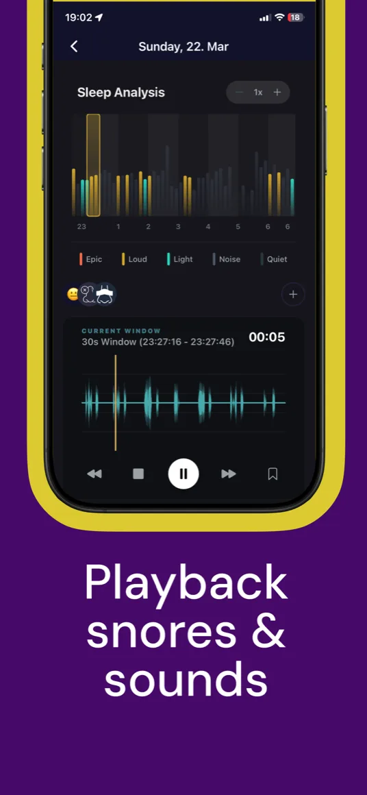 Playback snores and sounds — Snorely sleep analysis timeline with waveform player